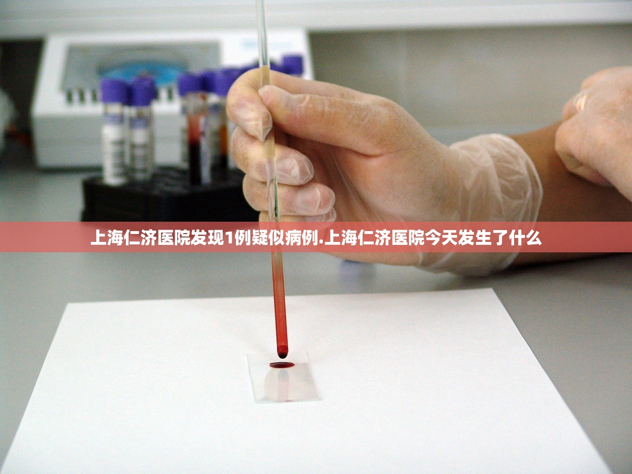 南京疫情真实情况︰(南京疫情详情)