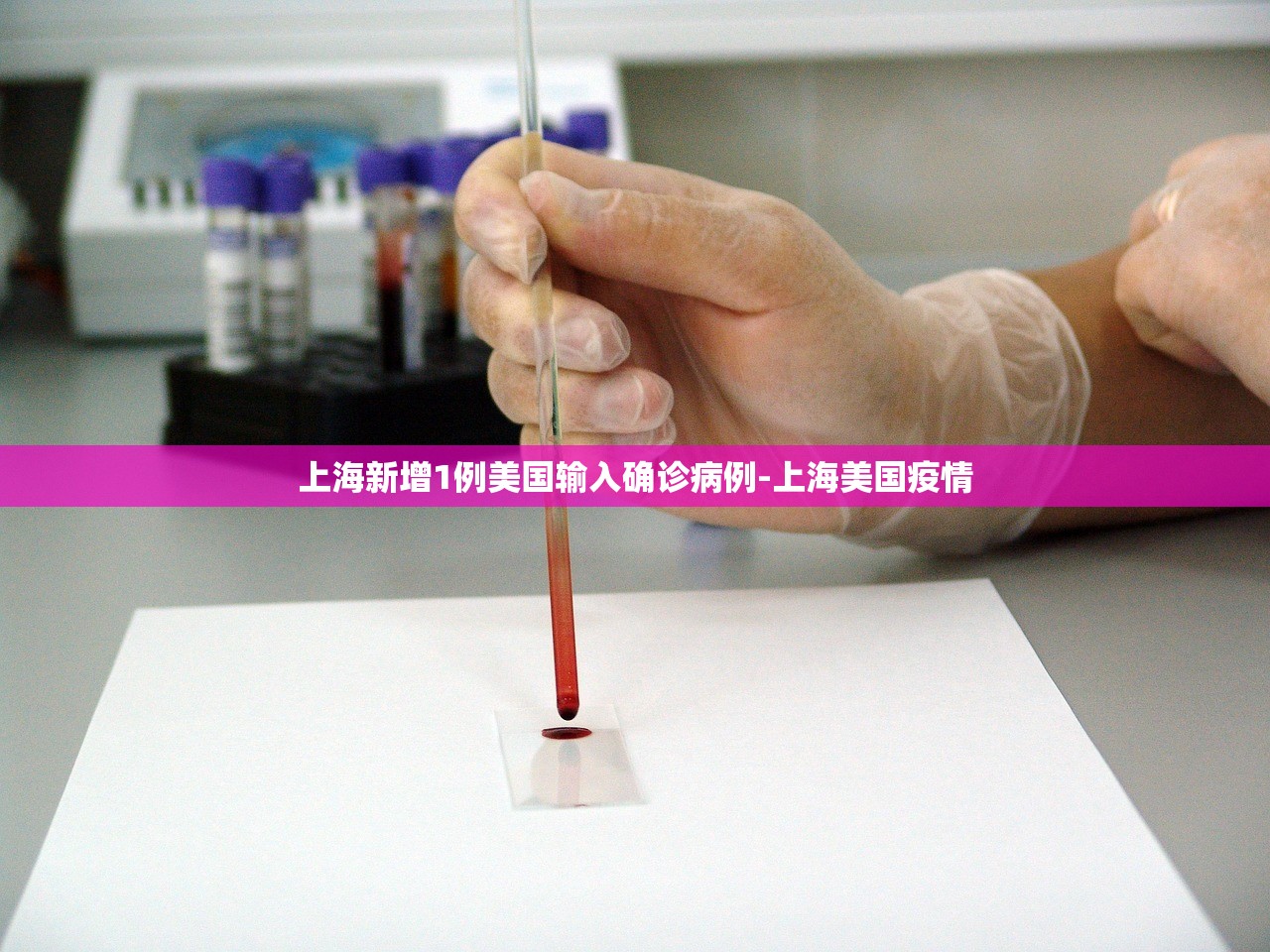 上海新增1例美国输入确诊病例-上海美国疫情