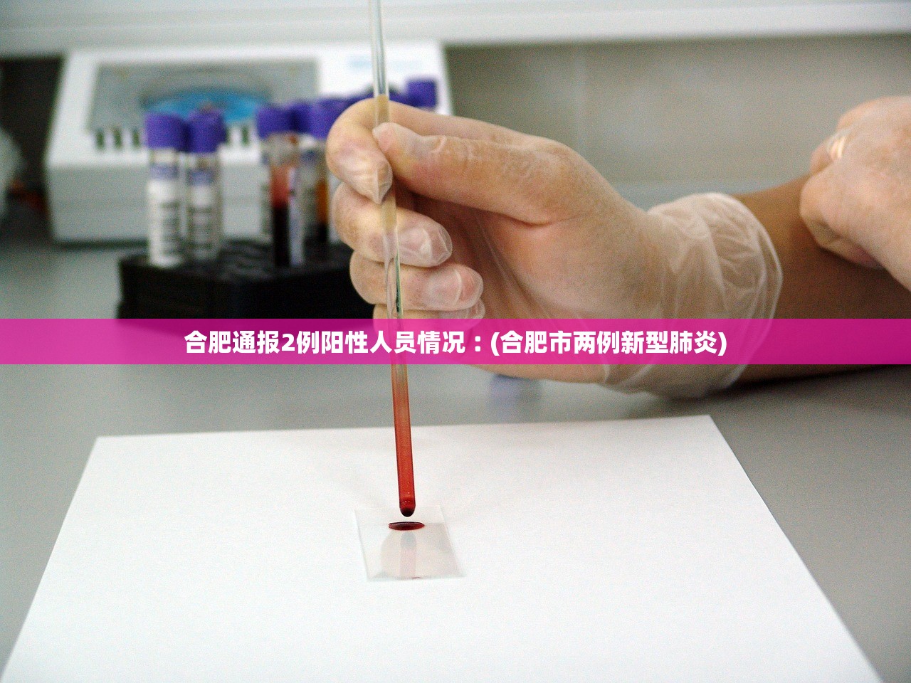 合肥通报2例阳性人员情况︰(合肥市两例新型肺炎) 合肥通报2例阳性人员情况︰(合肥市两例新型肺炎)