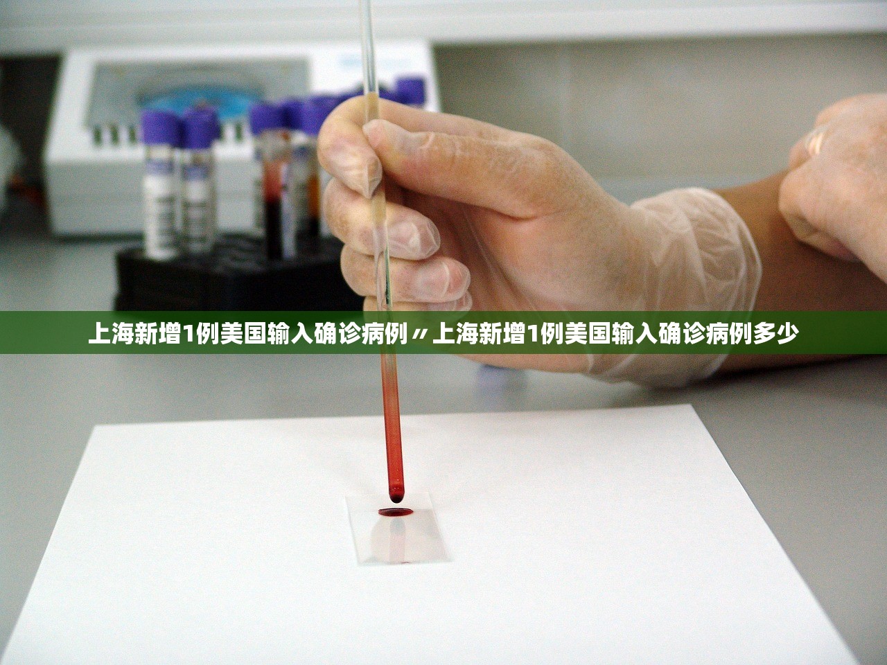 上海新增1例美国输入确诊病例〃上海新增1例美国输入确诊病例多少 上海新增1例美国输入确诊病例〃上海新增1例美国输入确诊病例多少